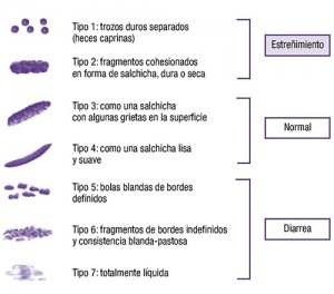 heces formas